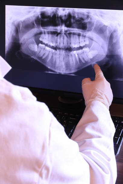 Best Emergency Dental Care for Broken or Chipped Teeth in Catlin, IL